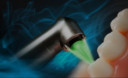 بخش دیگری از پزشکی که در آن از لیزر استفاده می شود دندانپزشکی است.