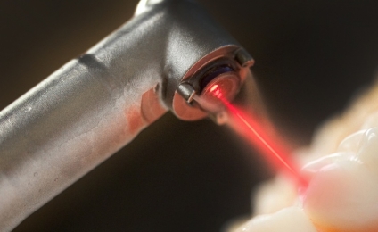 لیزرهای دیود در دندانپزشکی