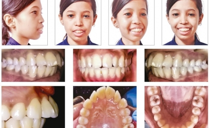 توجه به مراقبتهای دهان و دندان در بیماران مبتلا به تالاسمی